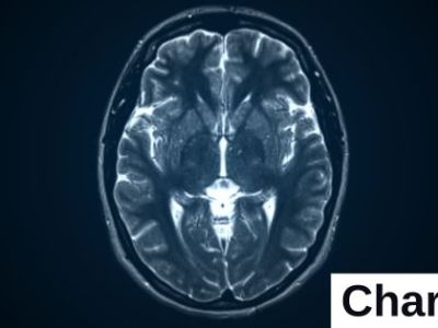 Update: Doctor Sentenced for Health Care&nbsp;Fraud